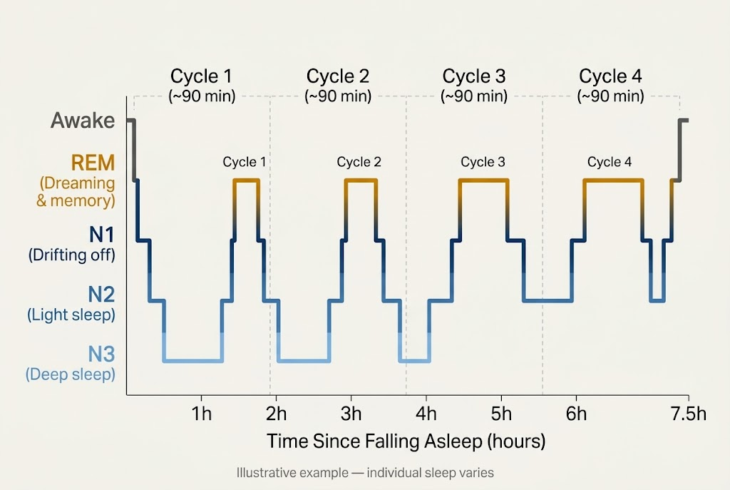 sleep cycle four stages N1 N2 N3 REM hypnogram chart